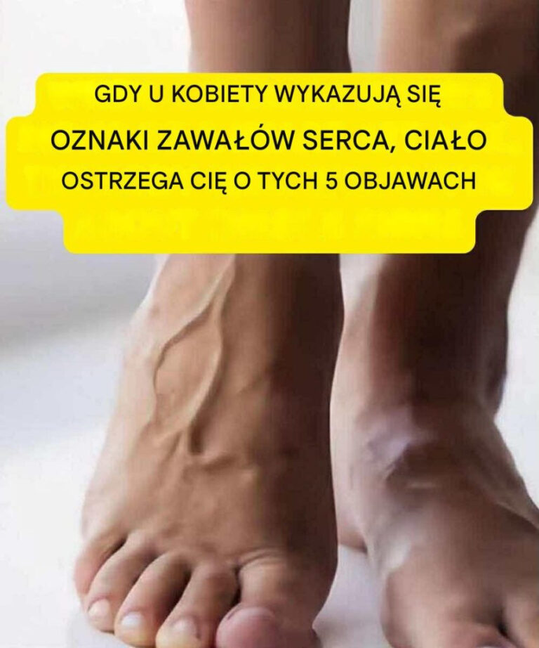5_objaw_w_u_kobiet__kt_re_wskazuj__na_zbli_aj_cy_si__atak_serca