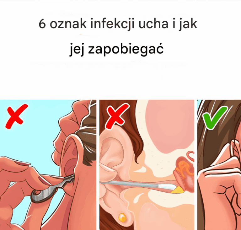 6_objaw_w__kt_re_mog__wyst_pi__lub_nie_wyst_pi__w_przysz_o_ci