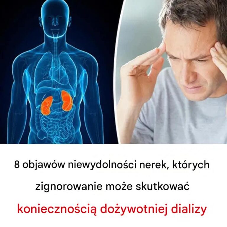 8_objaw_w_niewydolno_ci_nerek__kt_rych_zignorowanie_mo_e_skutkowa__konieczno_ci__do_ywotniej_dializy