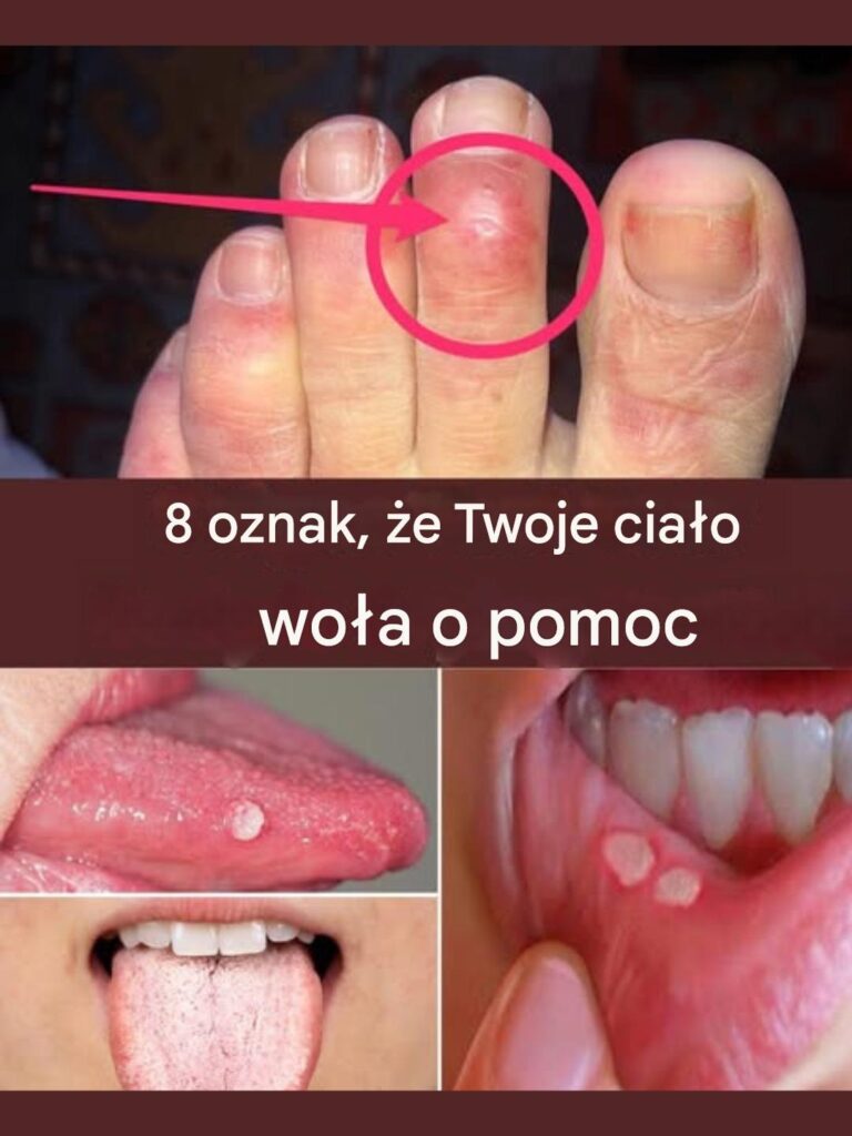 8_oznak___e_Twoje_cia_o_wo_a_o_pomoc___nie_ignoruj___tych_cichych_sygna__w_SOS_____ 8_oznak___e_Twoje_cia_o_wo_a_o_pomoc___nie_ignoruj___tych_cichych_sygna__w_SOS_____