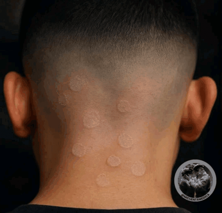 Alarm_medyczny__Wykryto_ognisko_grzybicy_w_salonach_fryzjerskich_i_barbershopach