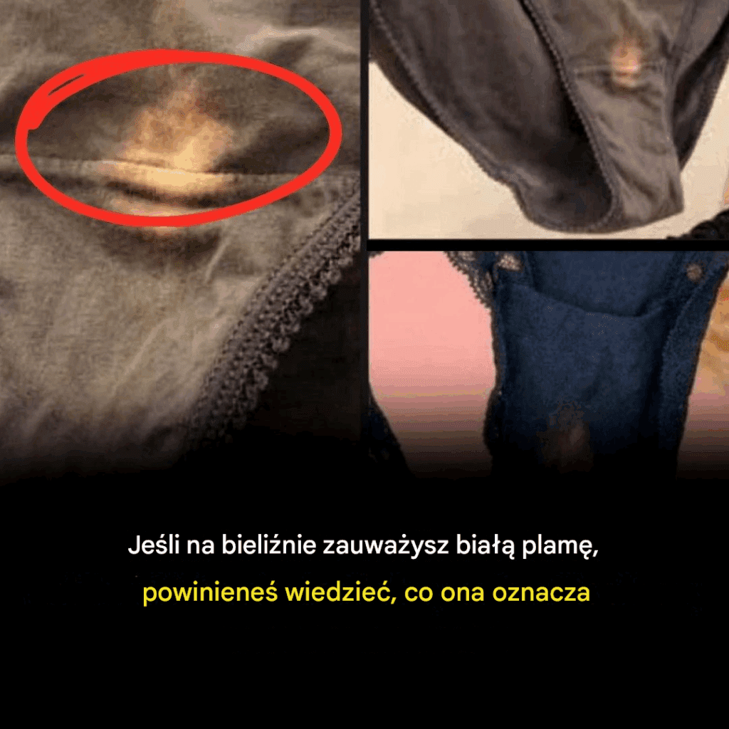 Co_oznacza_bia_a_plama_na_bieli_nie Co_oznacza_bia_a_plama_na_bieli_nie
