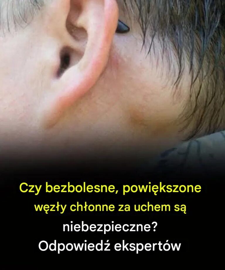 Czy_bezbolesne__powi_kszone_w_z_y_ch_onne_za_uchem_s__niebezpieczne_