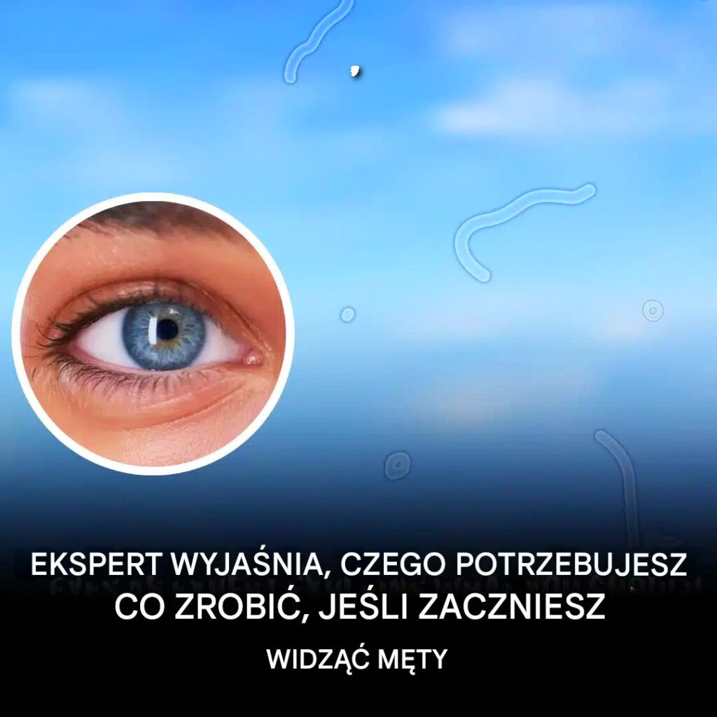 Ekspert_wyja_nia__co_zrobi___gdy_zaczniesz_dostrzega___m_ty__w_oczach Ekspert_wyja_nia__co_zrobi___gdy_zaczniesz_dostrzega___m_ty__w_oczach