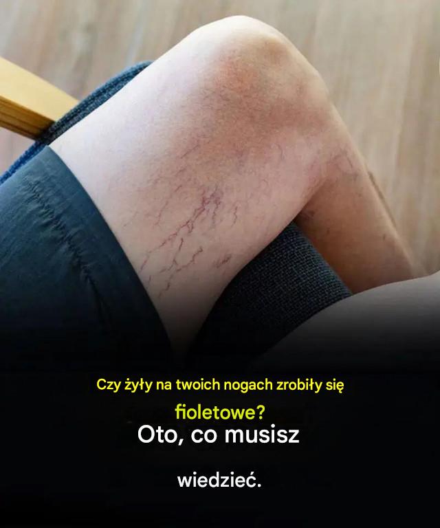 Fioletowe__y_y_na_nogach__od_kosmetyku_do_ryzyka_ Fioletowe__y_y_na_nogach__od_kosmetyku_do_ryzyka_