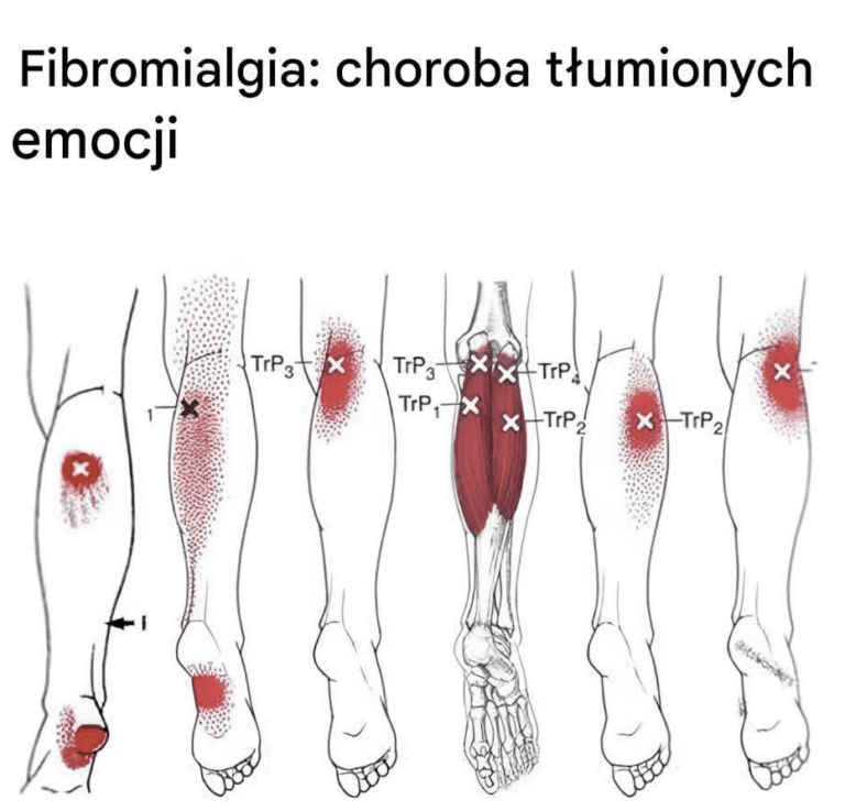 Jaki_jest_zwi_zek_pomi_dzy_fibromialgi__a_emocjami_