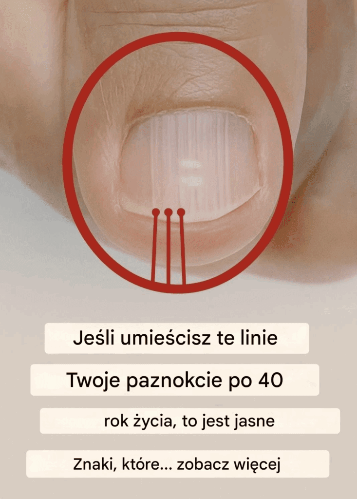 Je_li_po_40__roku__ycia_na_paznokciach_zaczynaj__pojawia__si__zmarszczki__mo_e_to_by__znak_ostrzegawczy_ Je_li_po_40__roku__ycia_na_paznokciach_zaczynaj__pojawia__si__zmarszczki__mo_e_to_by__znak_ostrzegawczy_