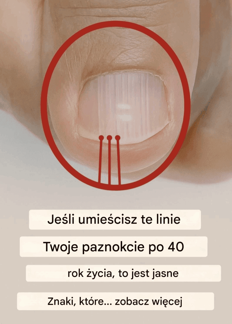 Je_li_po_40__roku__ycia_na_paznokciach_zaczynaj__pojawia__si__zmarszczki__mo_e_to_by__znak_ostrzegawczy_