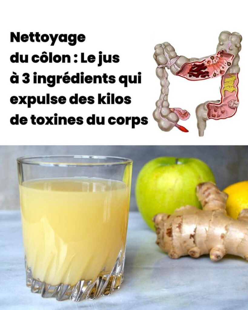 Jus_d_tox_pour_le_c_lon___pommes__gingembre_et_citron_pour__liminer_les_toxines_accumul_es Jus_d_tox_pour_le_c_lon___pommes__gingembre_et_citron_pour__liminer_les_toxines_accumul_es