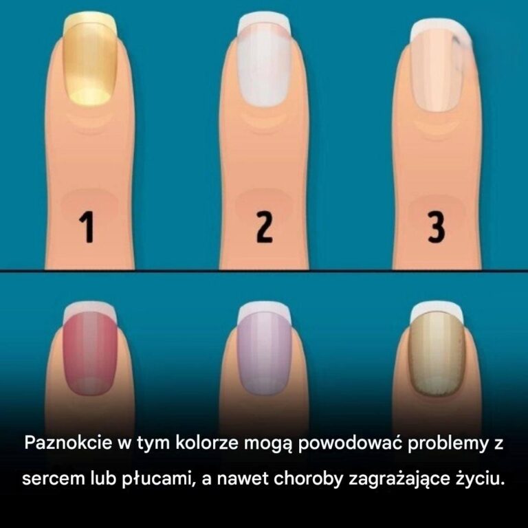 Kolor_paznokci_i_zdrowie__Co_paznokcie_mog__m_wi__o_Twoim_ciele