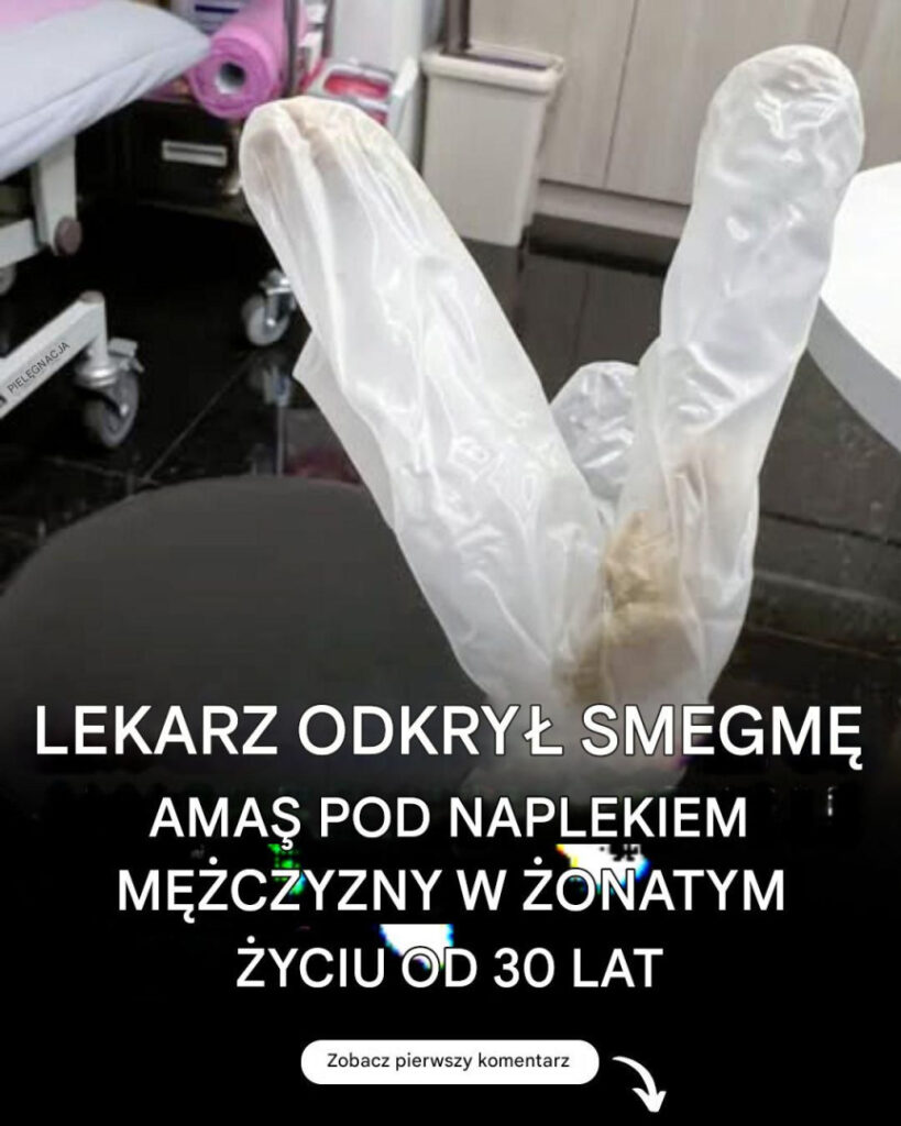 Lekarz_odkry__30_letnie_nagromadzenie_smegmy_pod_napletkiem__onatego_m__czyzny__kt_ry_cierpia__z_powodu_potwornego_b_lu Lekarz_odkry__30_letnie_nagromadzenie_smegmy_pod_napletkiem__onatego_m__czyzny__kt_ry_cierpia__z_powodu_potwornego_b_lu