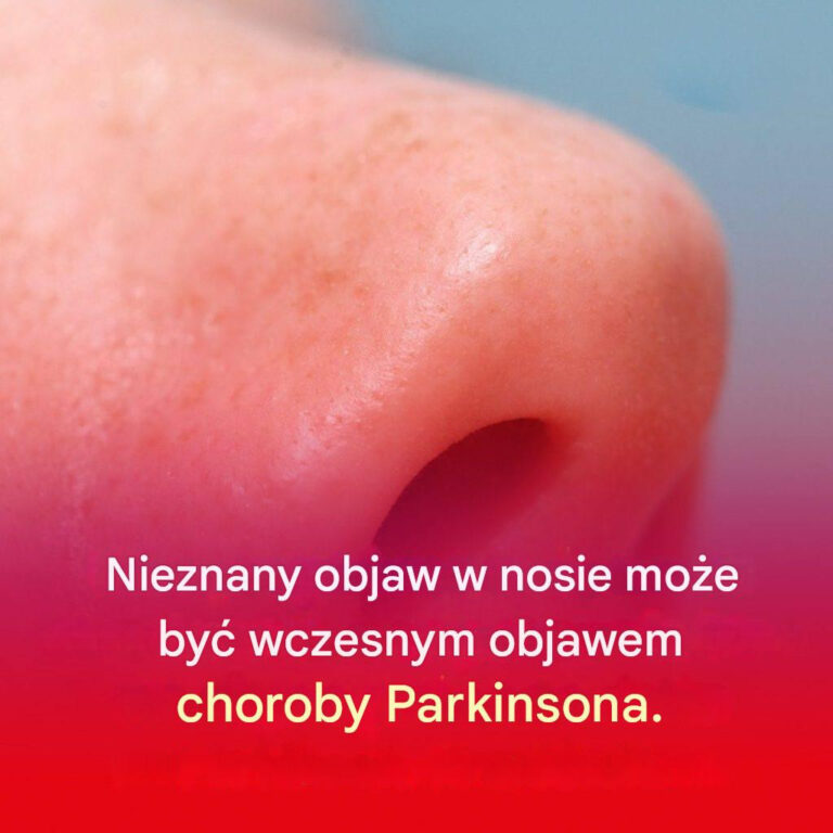 Ma_o_znany_objaw_w_nosie_mo_e_by__wczesnym_objawem_choroby_Parkinsona