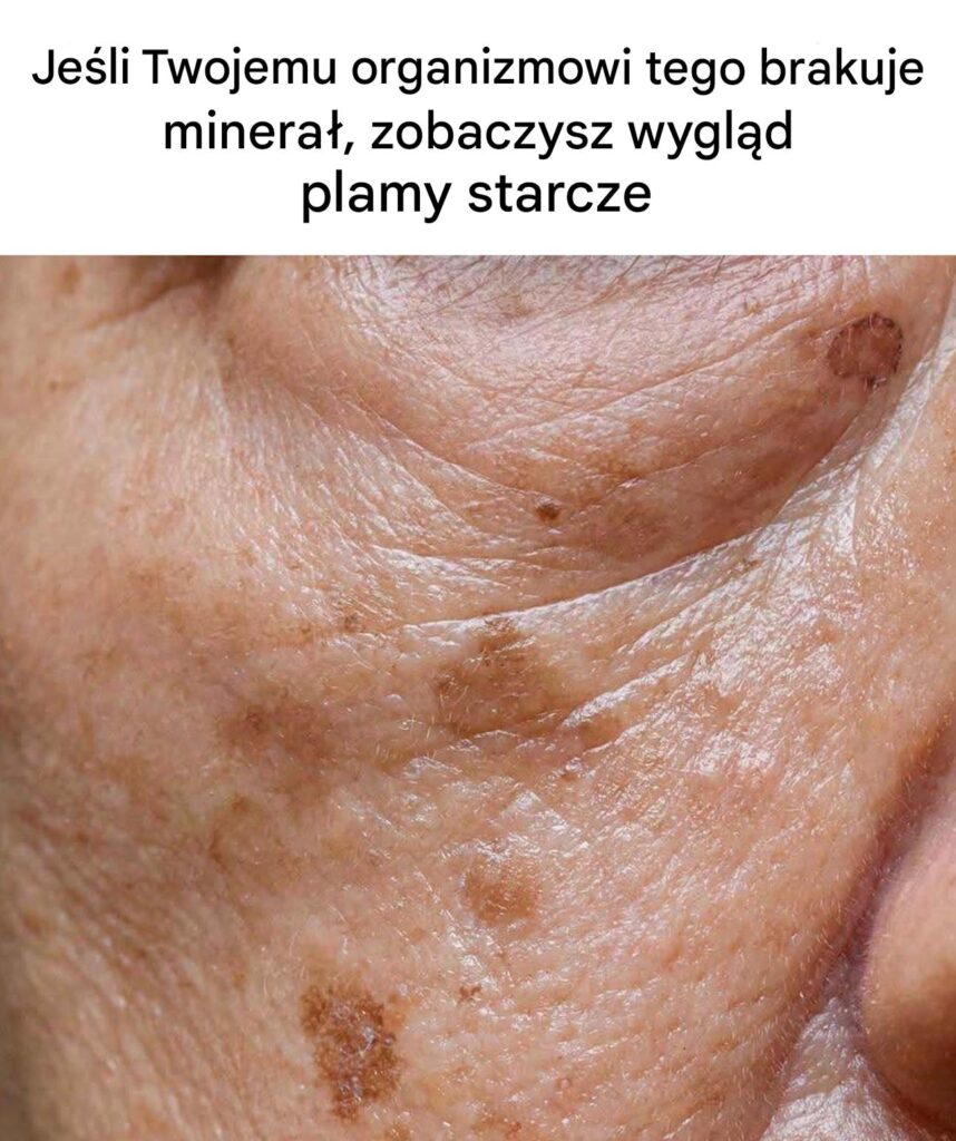 Niedob_r_tego_minera_u_zwi_ksza_ryzyko_pojawienia_si__plam_starczych_ Niedob_r_tego_minera_u_zwi_ksza_ryzyko_pojawienia_si__plam_starczych_