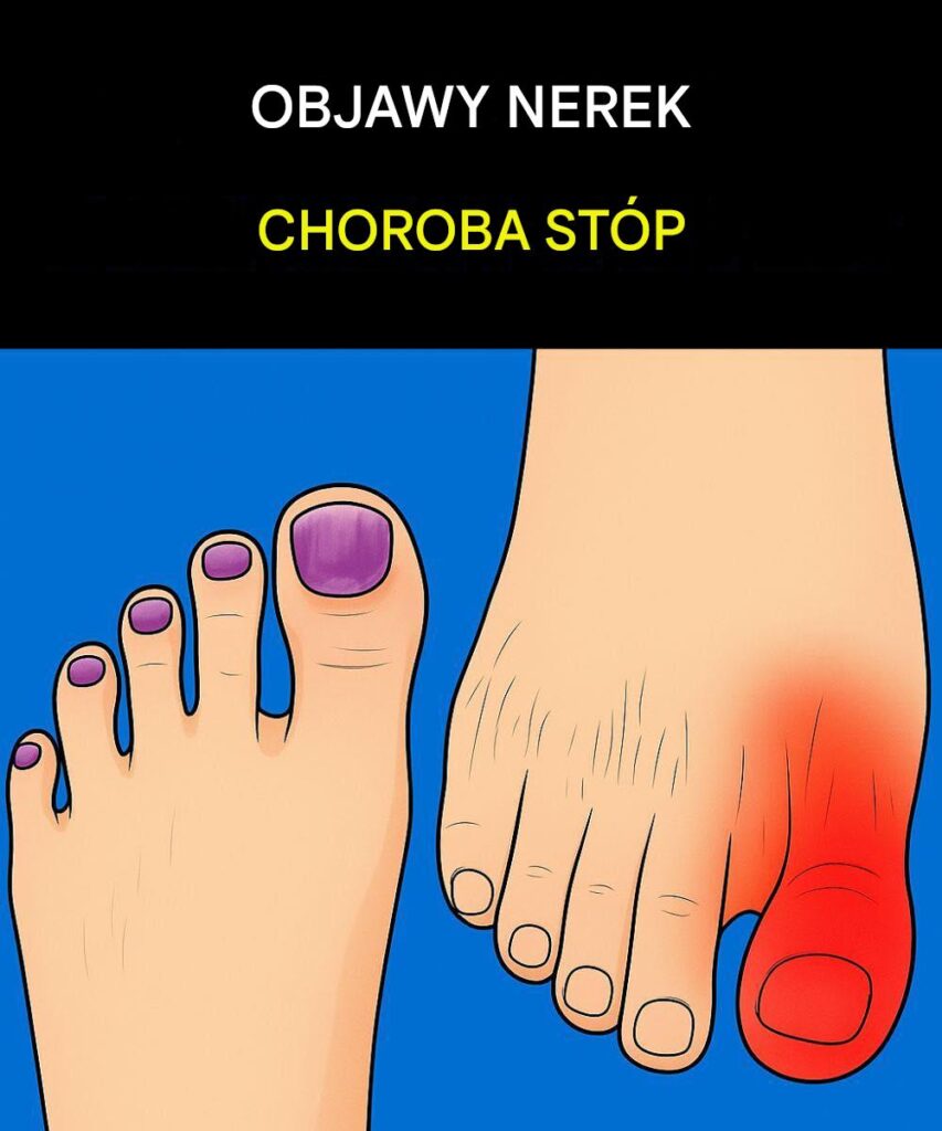 Objawy_choroby_nerek_w_stopach Objawy_choroby_nerek_w_stopach
