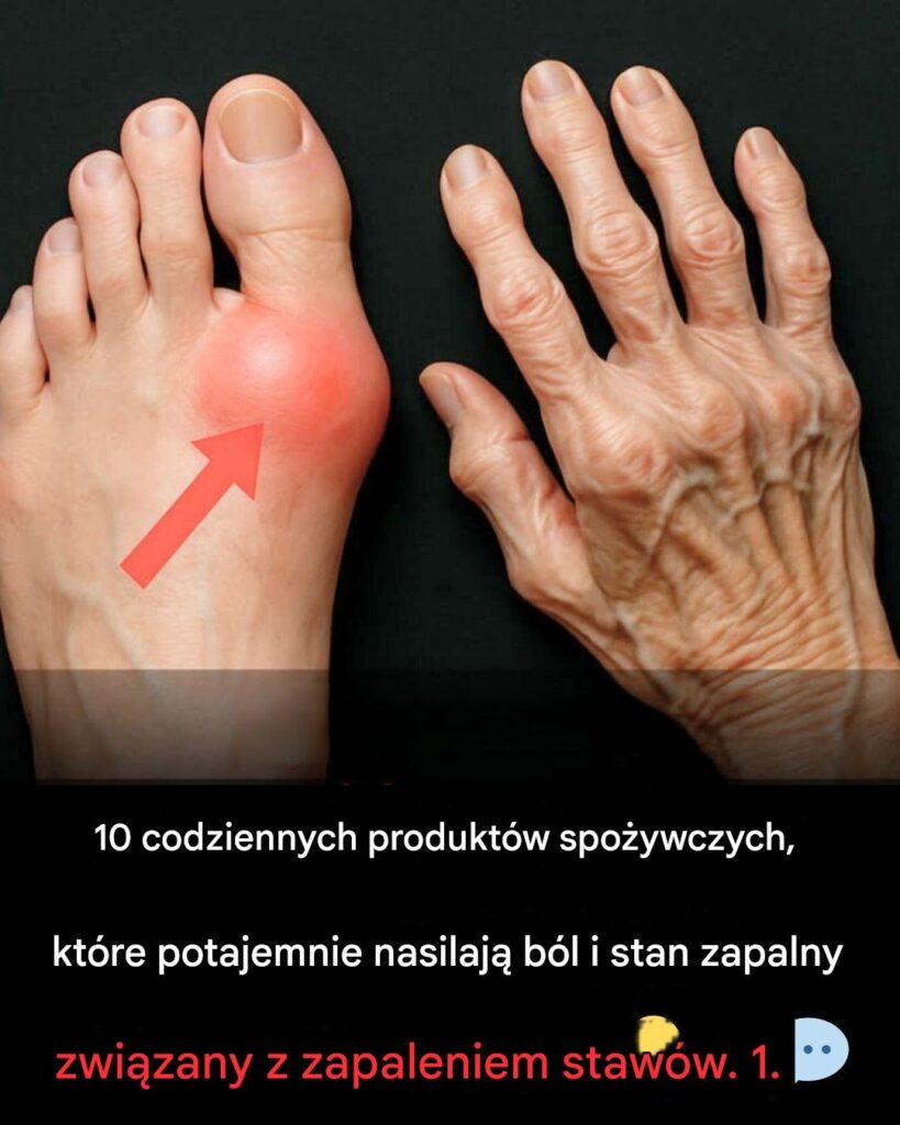 Ostrze_enie_dotycz_ce_zapalenia_staw_w__10_codziennych_produkt_w_spo_ywczych__kt_re_nasilaj__b_l_i_stan_zapalny Ostrze_enie_dotycz_ce_zapalenia_staw_w__10_codziennych_produkt_w_spo_ywczych__kt_re_nasilaj__b_l_i_stan_zapalny