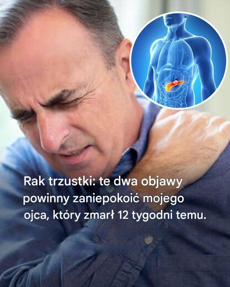 Rak_trzustki__10_objaw_w__kt_re_pomog__Ci_go_wykry___nie_ignoruj___ich_