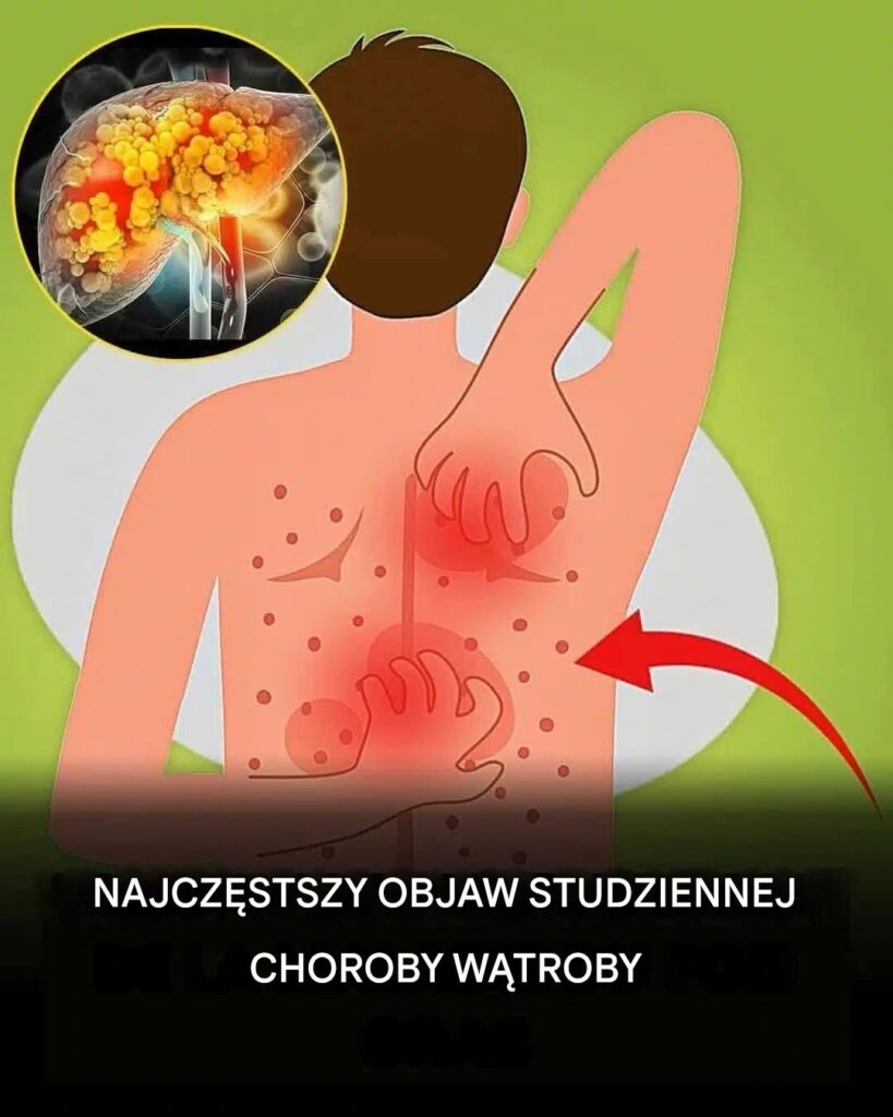 St_uszczenie_w_troby__przyczyny__objawy__leczenie St_uszczenie_w_troby__przyczyny__objawy__leczenie
