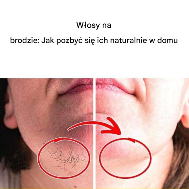 Usuwanie_w_osk_w_z_brody_bez_uszkadzania_sk_ry__naturalne_rozwi_zanie