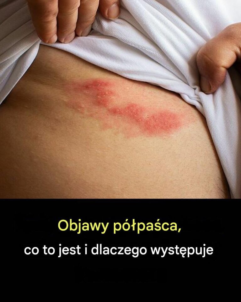 Wszystko__co_musisz_wiedzie__o_p__pa_cu__przyczyny__wczesne_wykrywanie_i_naturalne_leczenie_