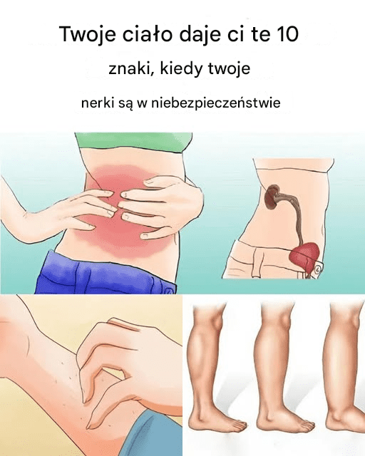 10_objaw_w_choroby_nerek 10_objaw_w_choroby_nerek