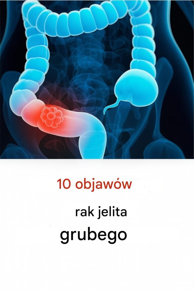 10_objaw_w_raka_jelita_grubego