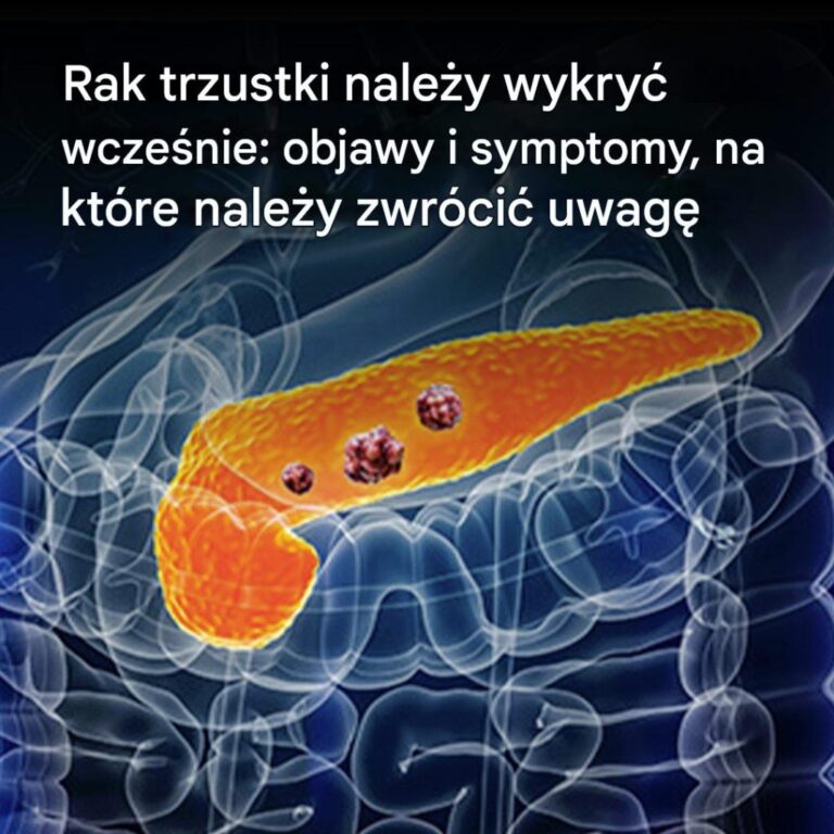 10_oznak_raka_trzustki__kt_rych_nie_nale_y_ignorowa_-1