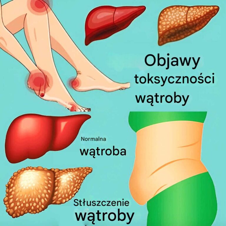 11_oznak_dysfunkcji_w_troby_i_gromadzenia_si__toksyn_w_organizmieW_troba_to_jeden_z_kluczowych_organ_w_naszego_cia_a__To_prawdziwy__naturalny_filtr__kt_ry_usuwa_toksyny_i_pe_ni_wiele_wa_nych_funkcji_