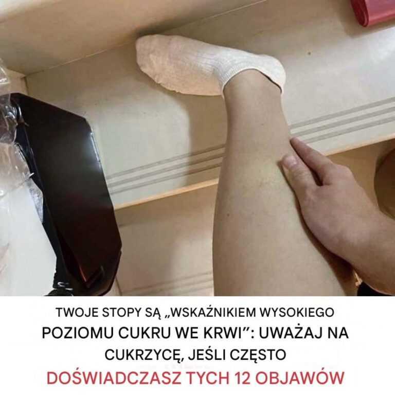 12_objaw_w_hipoglikemii__kt_re_nale_y_rozpozna_