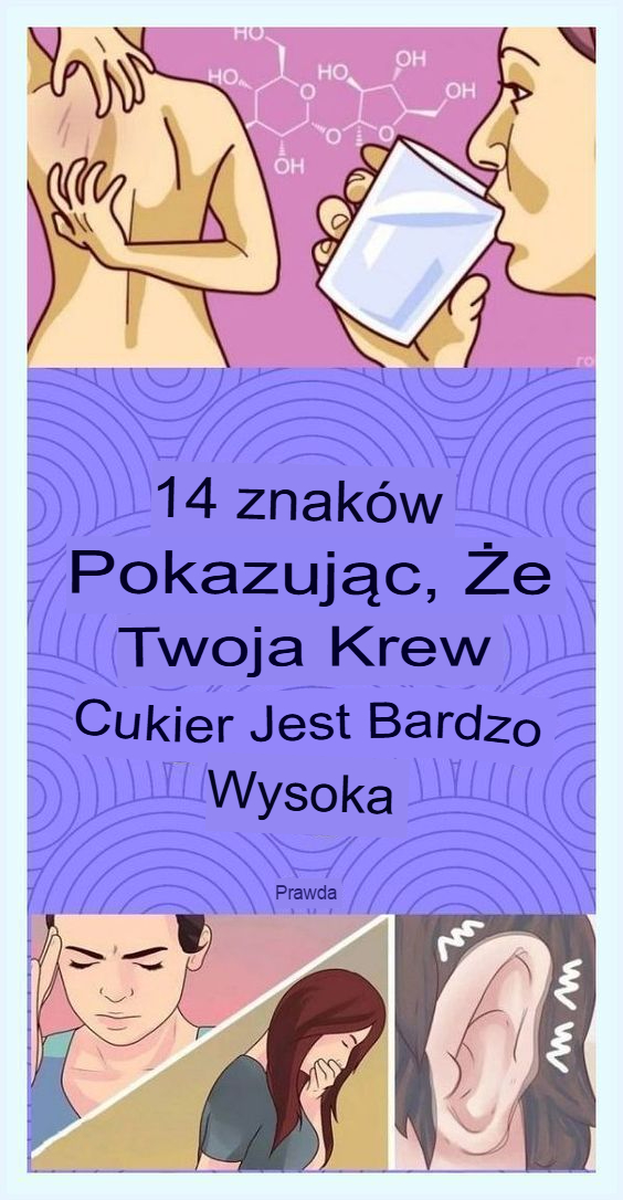 14_OZNAK___E_JESZ_ZA_DU_O_CUKRU_