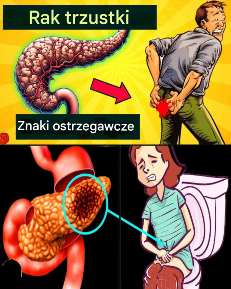 15_cichych_objaw_w_raka_trzustki__kt_re_powiniene__zna_