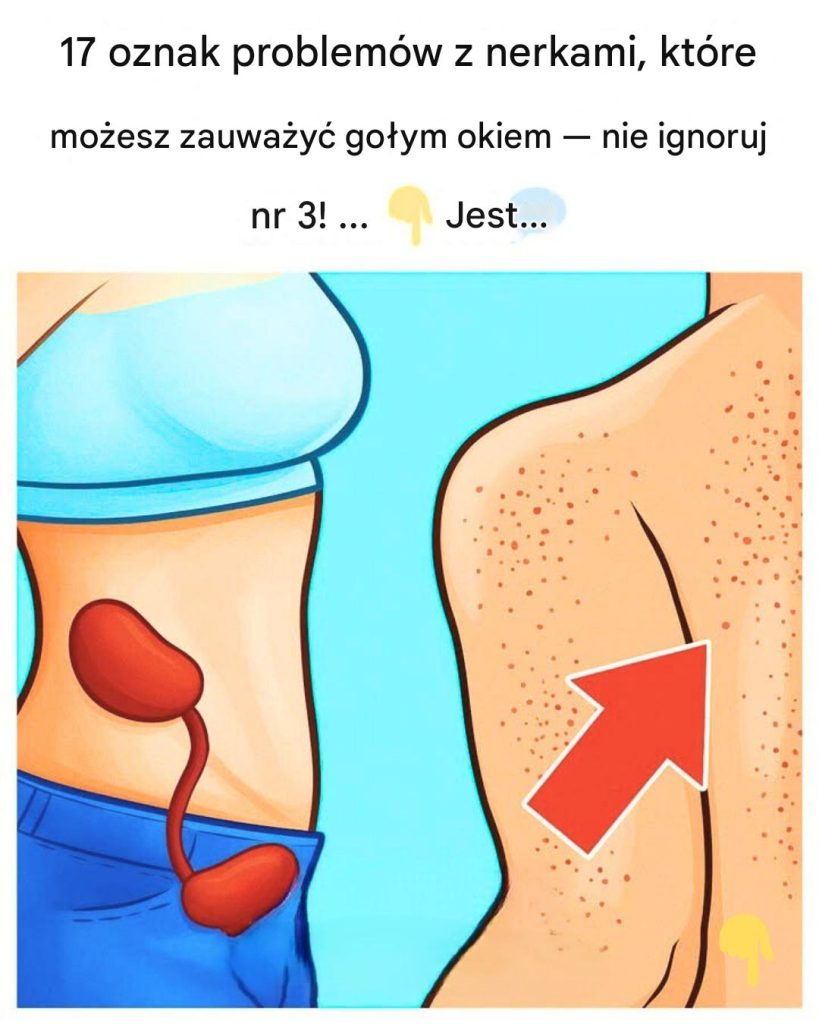 17_oznak_problem_w_z_nerkami__kt_re_mo_esz_zauwa_y____nie_ignoruj___nr_3_ 17_oznak_problem_w_z_nerkami__kt_re_mo_esz_zauwa_y____nie_ignoruj___nr_3_