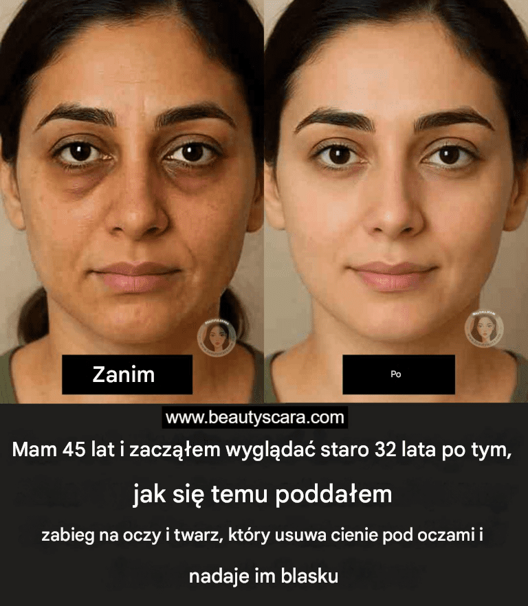 6_masek_do_kawy_do_cieni_pod_oczami___Zmarszczki_pod_oczami___Worki_na_oczy_i_opuchni_te_oczy 6_masek_do_kawy_do_cieni_pod_oczami___Zmarszczki_pod_oczami___Worki_na_oczy_i_opuchni_te_oczy