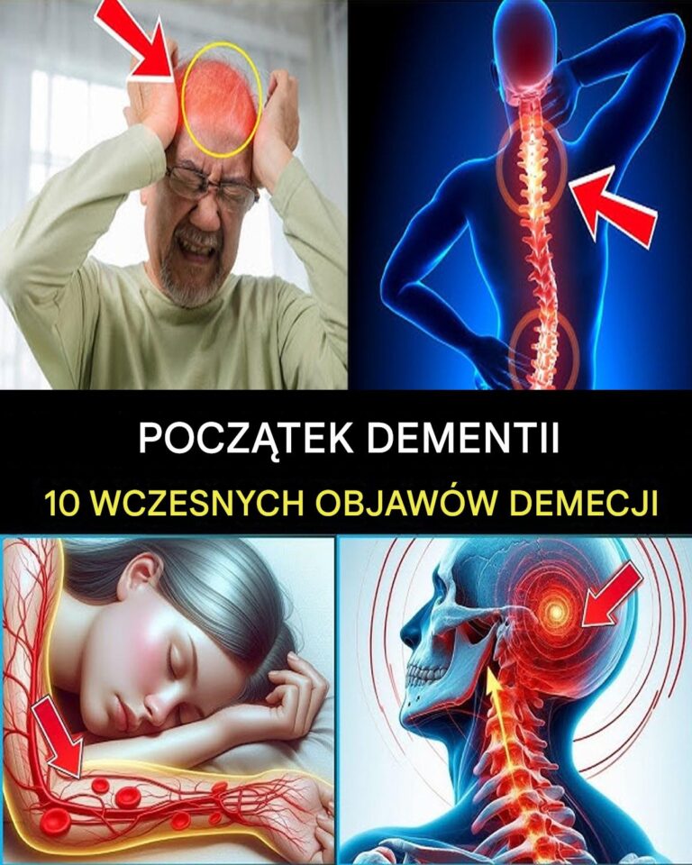 7_WCZESNYCH_OBJAW_W_CHOROBY_ALZHEIMERA__KT_RYCH_NIGDY_NIE_NALE_Y_IGNOROWA__