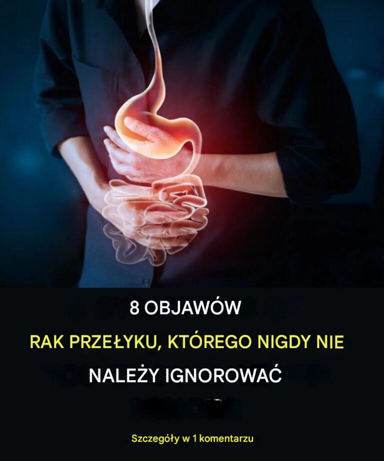 8_OBJAW_W_RAKA_PRZE_YKU__KT_RYCH_NIGDY_NIE_NALE_Y_IGNOROWA_