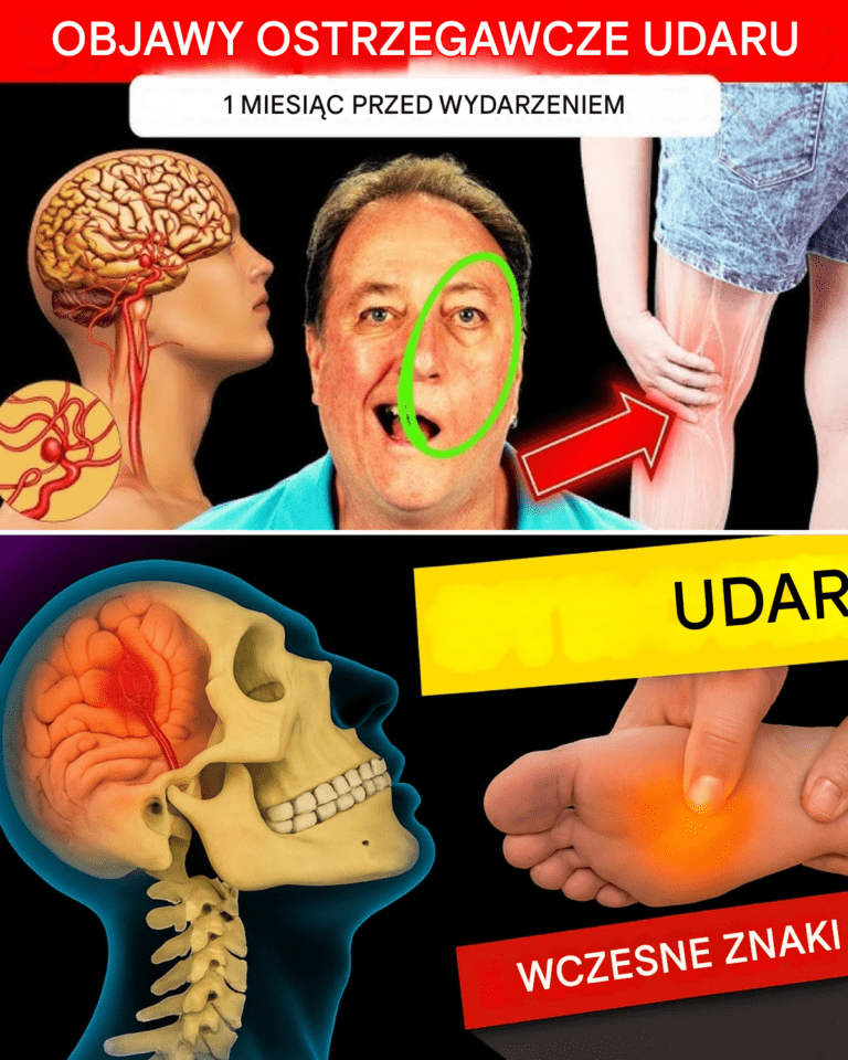 8_ostrzegawczych_objaw_w_udaru_i_9_wskaz_wek__jak_mu_zapobiega_