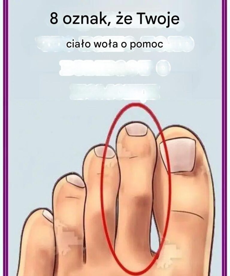 8_oznak___e_Twoje_cia_o_wo_a_o_pomoc_