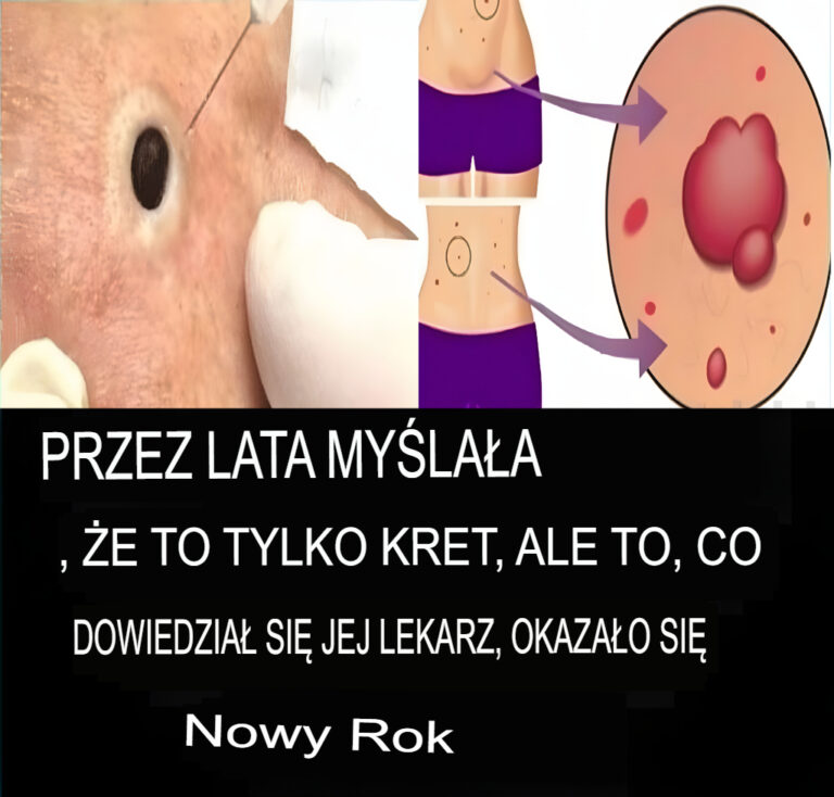 9_ostrzegawczych_sygna__w___e_w_Twoim_organizmie_rozwija_si__rak__kt_re_kobiety_cz_sto_ignoruj__