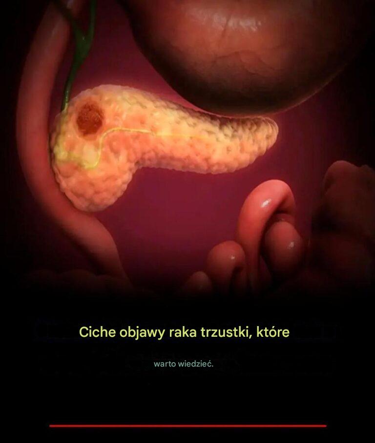 Ciche_objawy_raka_trzustki__kt_re_powiniene__zna_ Ciche_objawy_raka_trzustki__kt_re_powiniene__zna_