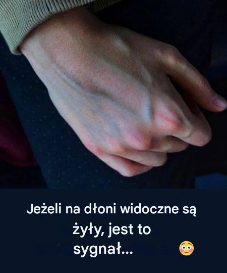 Co__y_y_na_d_oniach_mog__powiedzie__o_zdrowiu_w_troby Co__y_y_na_d_oniach_mog__powiedzie__o_zdrowiu_w_troby