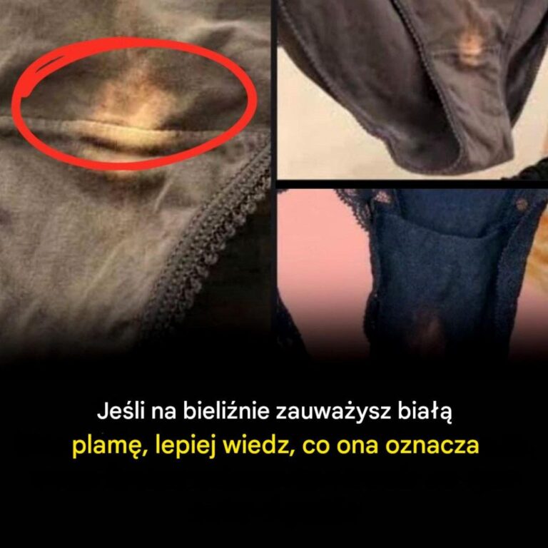Co_oznacza_bia_a_plama_na_bieli_nie
