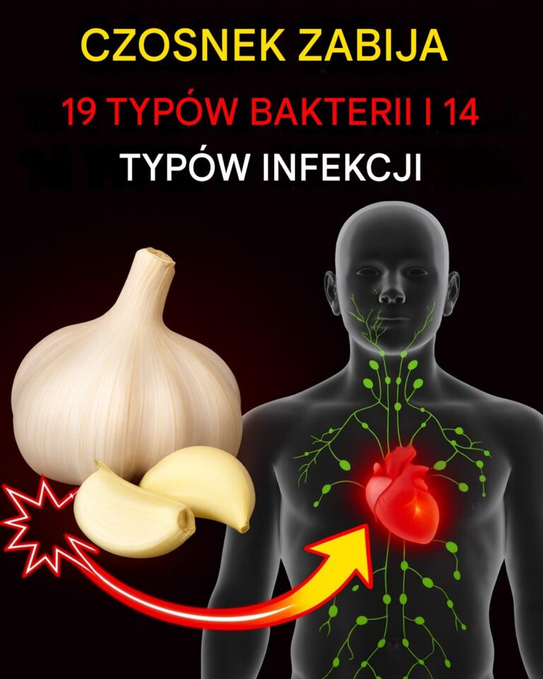 Czy_to_prawda___e___czosnek_zabija_14_rodzaj_w_bakterii_i_13_rodzaj_w_infekcji_-1