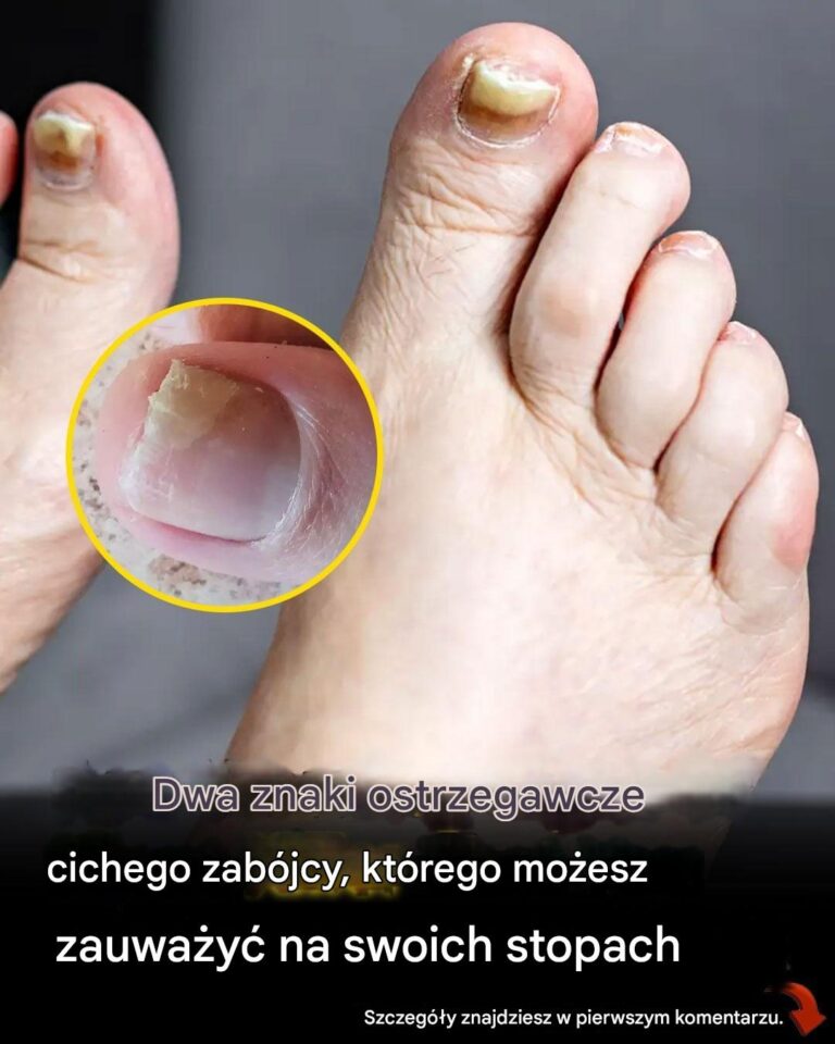 Ekspert_ds__zdrowia_ujawnia_ostrzegawcze_objawy_dw_ch_ukrytych_chor_b_st_p_i_jak_je_rozpozna_-2