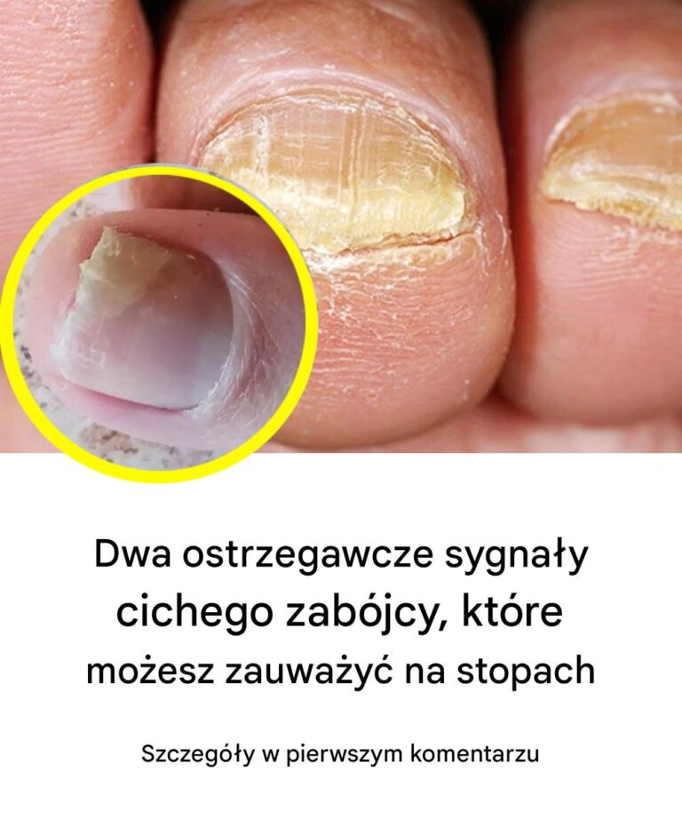 Ekspert_ds__zdrowia_ujawnia_ostrzegawcze_sygna_y_dw_ch_cichych_przyczyn__mierci_st_p_i_jak_je_rozpozna_