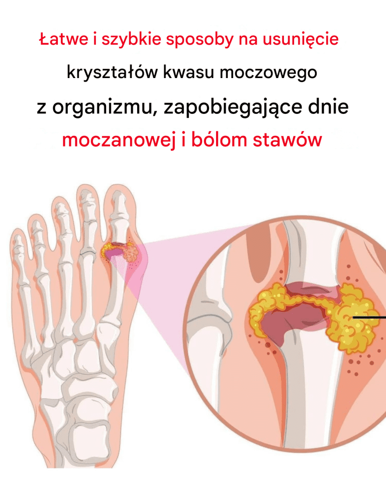 Jak_naturalnie_odwr_ci__dn__moczanow__i_z_agodzi__b_l_staw_w