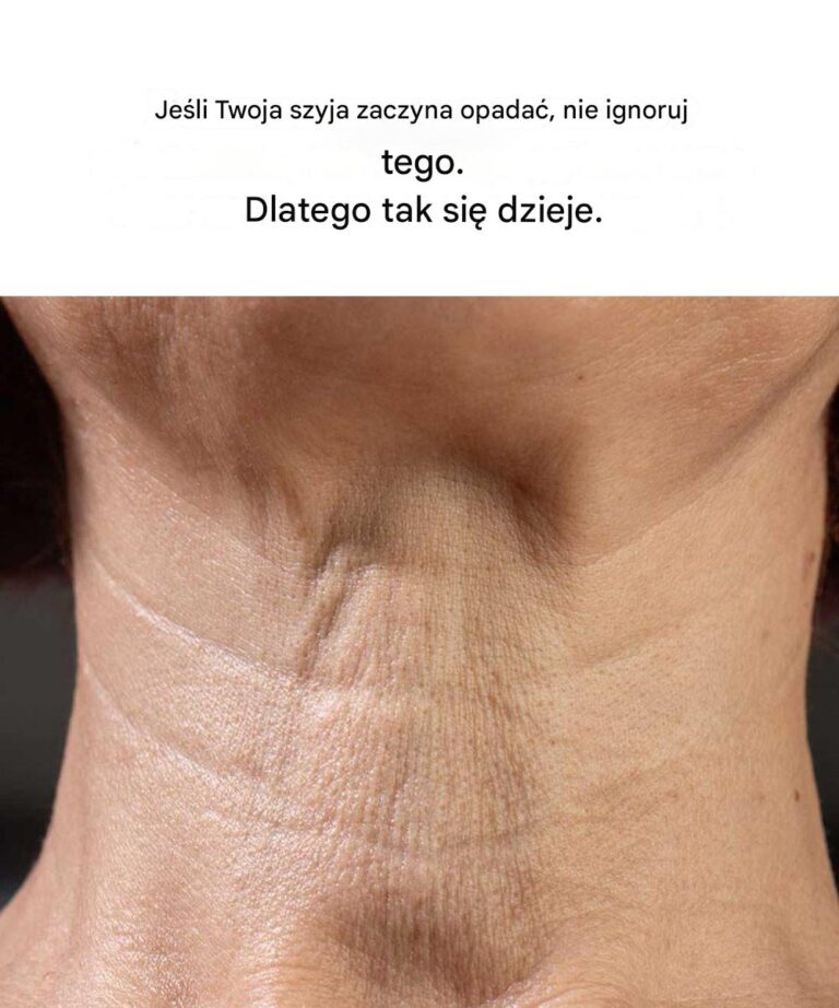 Je_li_Twoja_szyja_zaczyna_opada___nie_ignoruj___tego__Oto_przyczyna_
