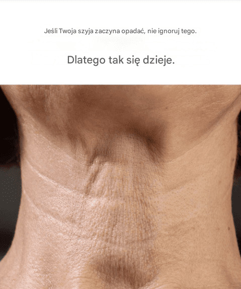 Je_li_Twoja_szyja_zaczyna_opada___nie_ignoruj___tego__Oto_przyczyna_