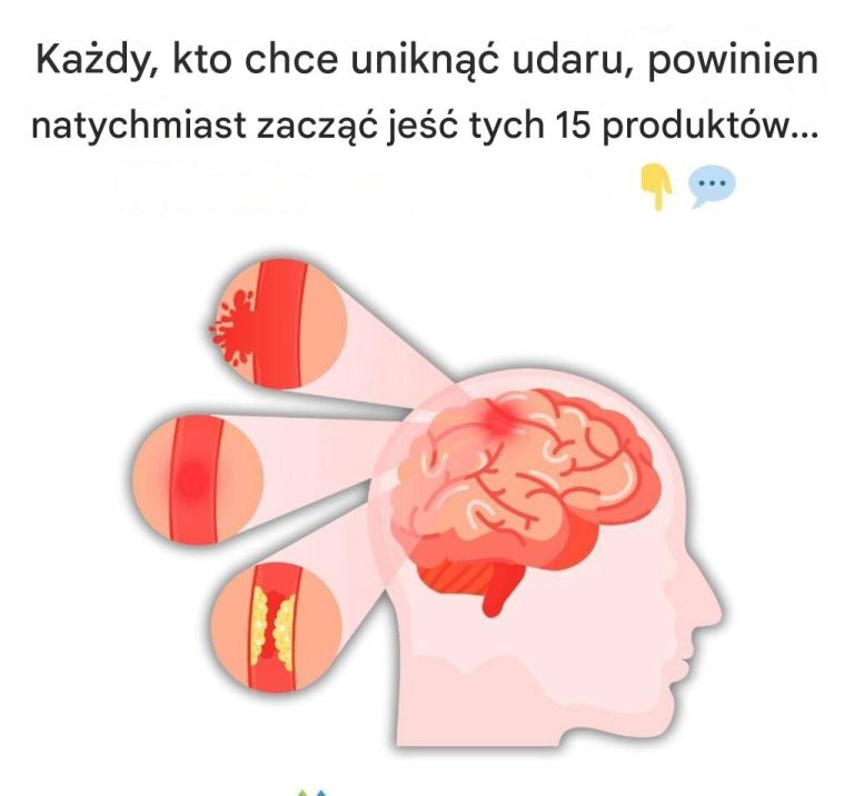 Ka_dy__kto_chce_unikn___udaru__powinien_natychmiast_zacz___je___te_15_produkt_w