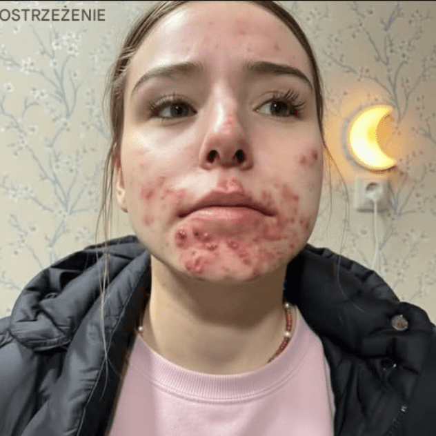 Oto_konsekwencje_utrzymywania_bliskich_relacji_z___niew_a_ciw__osob__-1 Oto_konsekwencje_utrzymywania_bliskich_relacji_z___niew_a_ciw__osob__-1