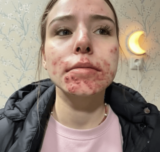 Oto_konsekwencje_utrzymywania_bliskich_relacji_z___niew_a_ciw__osob__ Oto_konsekwencje_utrzymywania_bliskich_relacji_z___niew_a_ciw__osob__