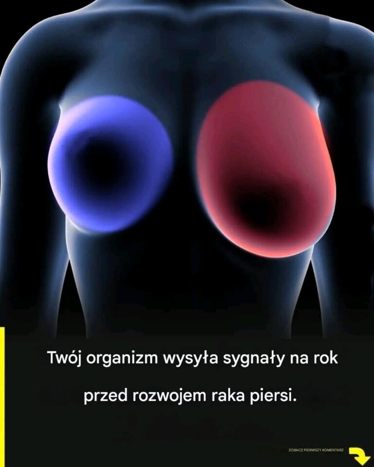Rak_piersi__4_wczesne_objawy__kt_re_powinna_zna__ka_da_kobieta